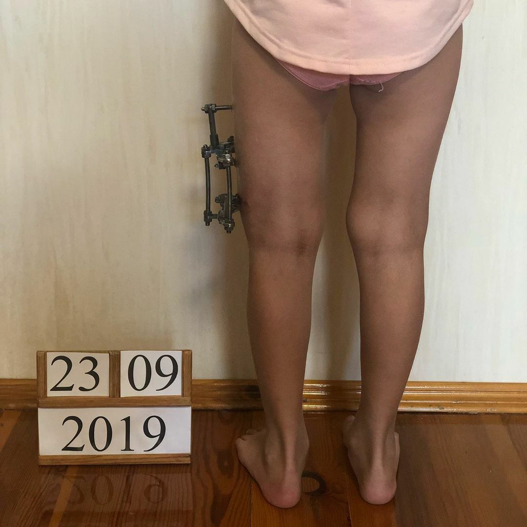 Крем для ног и потрескавшихся пяток 03 серия Мочевина