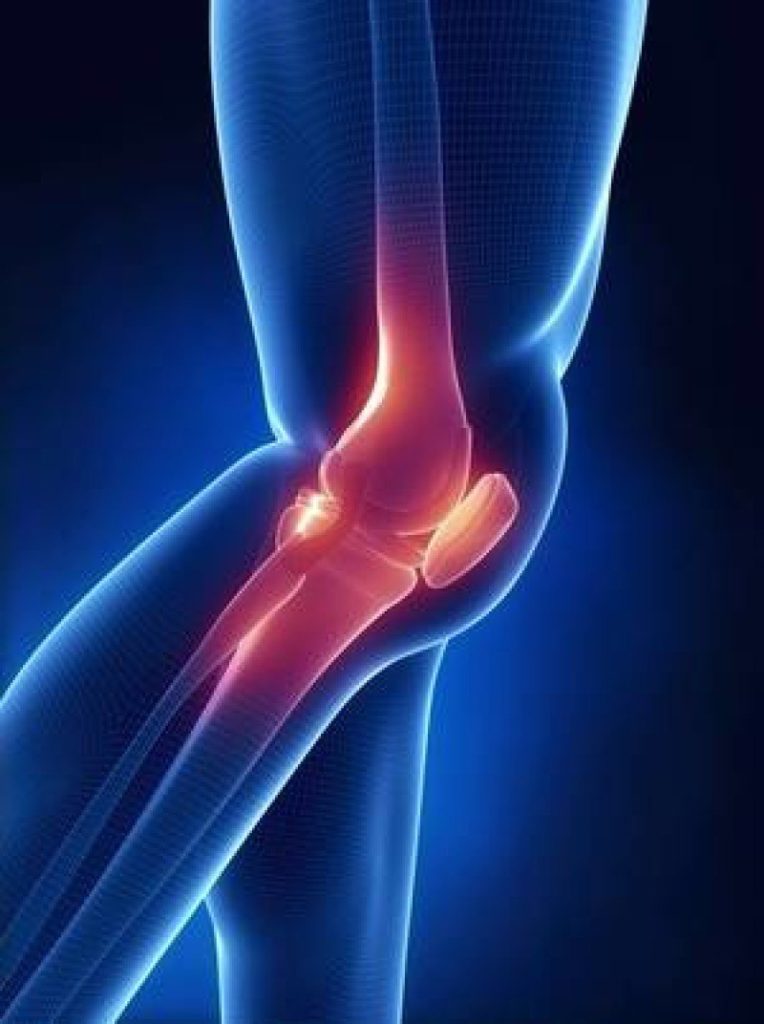 аномалии развития коленного сустава